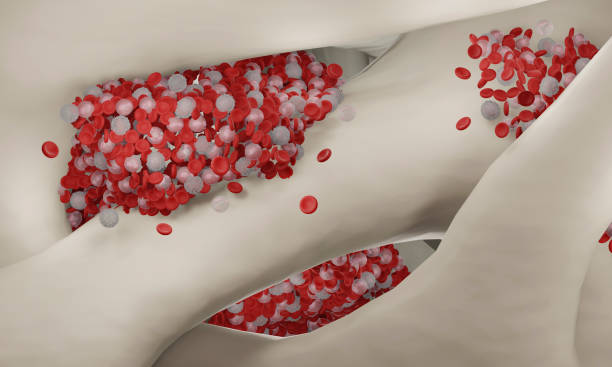 Complete Bone Marrow Disorders Care at Livasa Hoshiarpur - Reliable Blood Disease Treatment